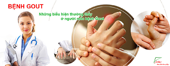 NỤ VỐI HỖ TRỢ ĐIỀU TRỊ BỆNH GOUT